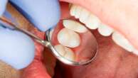 NHS dentists 'very weak' and 'not fit for purpose', health leaders warn