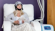 'Milestone' technique could help cancer patients keep hair during chemotherapy
