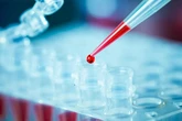Вчені виявили антитіло, що блокує майже всі варіанти ВІЛ-інфекції