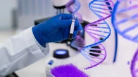 Збір ДНК українців в Іспанії для пошуку зниклих родичів: як записатись та скільки триватиме