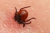 У США зафіксували першу смерть від алергії на м’ясо після укусу кліща
