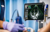 Samsung планує інвестувати 100 мільйонів у стартап Exo Imaging, що революціонізує медицину