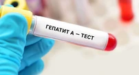 У Києві зафіксовано спалах гепатиту А - медики закликають до посиленої гігієни та вакцинації