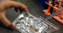 Carne coltivata, la Camera approva il testo. Cosa prevede e perché è a rischio di infrazione Ue