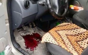 Біля Запоріжжя російський дрон поцілив в цивільну автівку, постраждало подружжя