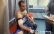 ​У Запоріжжі під час обшуку чоловік поранив ножем трьох поліцейських. Його застрелили