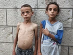 Skeletal children fill hospital wards as starvation grips Gaza