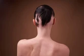 Alopecia: conheça os tipos, sintomas e tratamentos da perda de cabelo