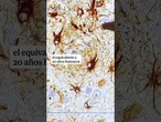 Consiguen revertir el Alzheimer el equivalente a 20 años humanos usando nanopartículas