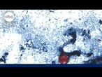 Cyclosporiasis outbreak raises new food safety concerns