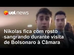 Nikolas Ferreira sai com rosto sangrando da Câmara após visita de Bolsonaro e encontro com aliados
