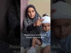 Palestinian child injured by Israeli strike in Gaza loses ability to speak