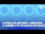 Syphilis,chlamydiose, gonocoque... Le nombre d'IST en hausse en France