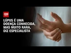 Lúpus é doença conhecida, mas bastante rara, conta especialista à Kalil | Sinais Vitais