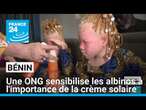 Bénin : une ONG sensibilise les albinos à l'importance de la crème solaire • FRANCE 24