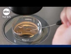 How custody agreement was reached in IVF mix-up