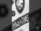 4th person dies from Legionnaires' disease in New York City: Health officials