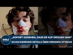 DRESDEN: Messerattacke durch Syrer in Straßenbahn! Opfer berichtet schockierende Details