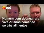 Homem com doença rara passa 20 anos comendo apenas três alimentos e suco de caixinha; entenda o caso