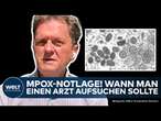 MPOX: WHO ruft Notlage aus! Wie hoch die Gefahr in Deutschland ist und wann man zum Arzt sollte