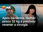 Mulher teve de reverter bariátrica após pesar 32 kg: 'Não conseguia comer nem beber nada'