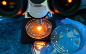 La bacteria "come carne" se encuentra en estos lugares: lo que debes saber para protegerte