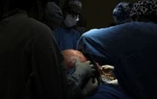 IMSS de Querétaro extirpa tumor ovárico de casi 23 kilogramos a paciente de 37 años (Video)