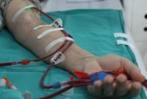 Chàng trai 32 tuổi suy thận sau nhiều năm sử dụng 'bổ thận tráng dương, tăng cơ'