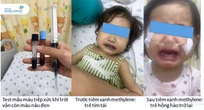 Máu của bé gái chuyển qua màu nâu sau khi ăn canh nấu bằng nước giếng