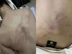 Gia đình tố cô giáo mầm non đánh, kéo lê, ném bé gái 4 tuổi vào tường