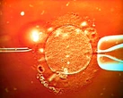 Người hiến tinh trùng mang gene ung thư, sinh ra ít nhất 67 trẻ, 10 em bị bệnh