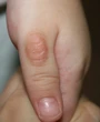 Thói quen mút ngón tay ở trẻ em: Hiểu đúng để phòng ngừa và điều trị