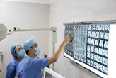 Hàng xóm dùng đũa nhựa đâm vào mắt, nhãn cầu phải của bệnh nhân bị biến dạng nặng