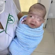 Trẻ sơ sinh 8 ngày tuổi bị uốn ván nặng