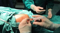 Nhức nhối thực trạng dùng tế bào trôi nổi: Bộ Y tế sẽ ban hành bộ tiêu chuẩn trong năm 2025
