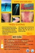 Mùa tắm biển, cẩn trọng với sứa lửa