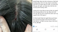 Chích máu đỉnh đầu, dái tai để chữa đột quỵ?