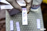 Có triệu chứng nghi ngờ mắc COVID-19, cần test nhanh không?