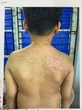 Khởi tố người cha đánh con ruột gây thương tích 36%