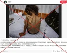 Bức ảnh bé gái 7 tuổi ở Dải Gaza bị nhầm là thiếu niên 17 tuổi chết vì đói