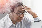 Tìm ra nguyên nhân kích hoạt bệnh Alzheimer