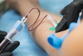 Xét nghiệm máu phát hiện ADN ung thư từ 3 năm trước khi chẩn đoán