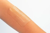 Keo sinh học dán kín vết thương chỉ trong 5 giây