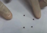 Bé trai nuốt 4 cục nam châm dính chặt vào nhau gây thủng ruột