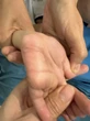 Xuất hiện 'những con đường ngoằn ngoèo kỳ lạ' trong lòng bàn tay trẻ 4 tuổi