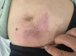 Xác minh vụ cô giáo lớp lá đánh hiệu phó trường mầm non đến nằm viện