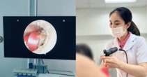 Bé gái 6 tuổi suýt thủng màng nhĩ vì một sợi dây buộc tóc