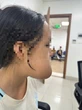 9 giờ liền phẫu thuật miễn phí cho thiếu nữ bị khối u khủng trên mặt
