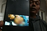 Asyik Berduaan di Pinggir Sungai Kalimas, Sejoli Jadi Korban Pembacokan OTK