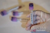 4 ABK Berlayar dari Jakarta Barat ke Somalia Suspek Hantavirus